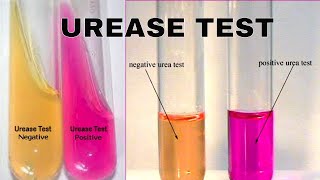 Urea Hydrolysis Urease Test [upl. by Delly654]