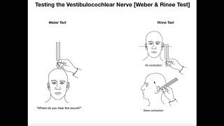 Interpreting the WeberRinne Tests EXPLAINED [upl. by Franklin]