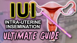 IUI  Fertility expert secrets for maximum pregnancy rates [upl. by Eimrej56]