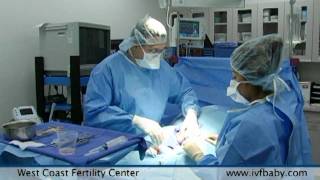 West Coast Fertility Centers Male Infertility Treatments [upl. by Janice]