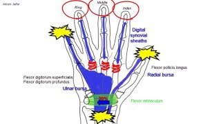 Why Common Patellar Tendonitis Rehab FAILS and 5 exercises that WORK [upl. by Kabab]