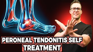 De Quervains Tenosynovitis Self Treatment and 5 General PT Questions with Dr Jun Reyes PT DPT [upl. by Yuria]